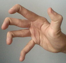 Hand Surgeon S Blog KAYVON IZADI MD HAND WRIST ELBOW ORTHOPEDIC SURGEON